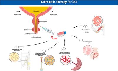 Advances in the molecular pathogenesis and cell therapy of stress urinary incontinence